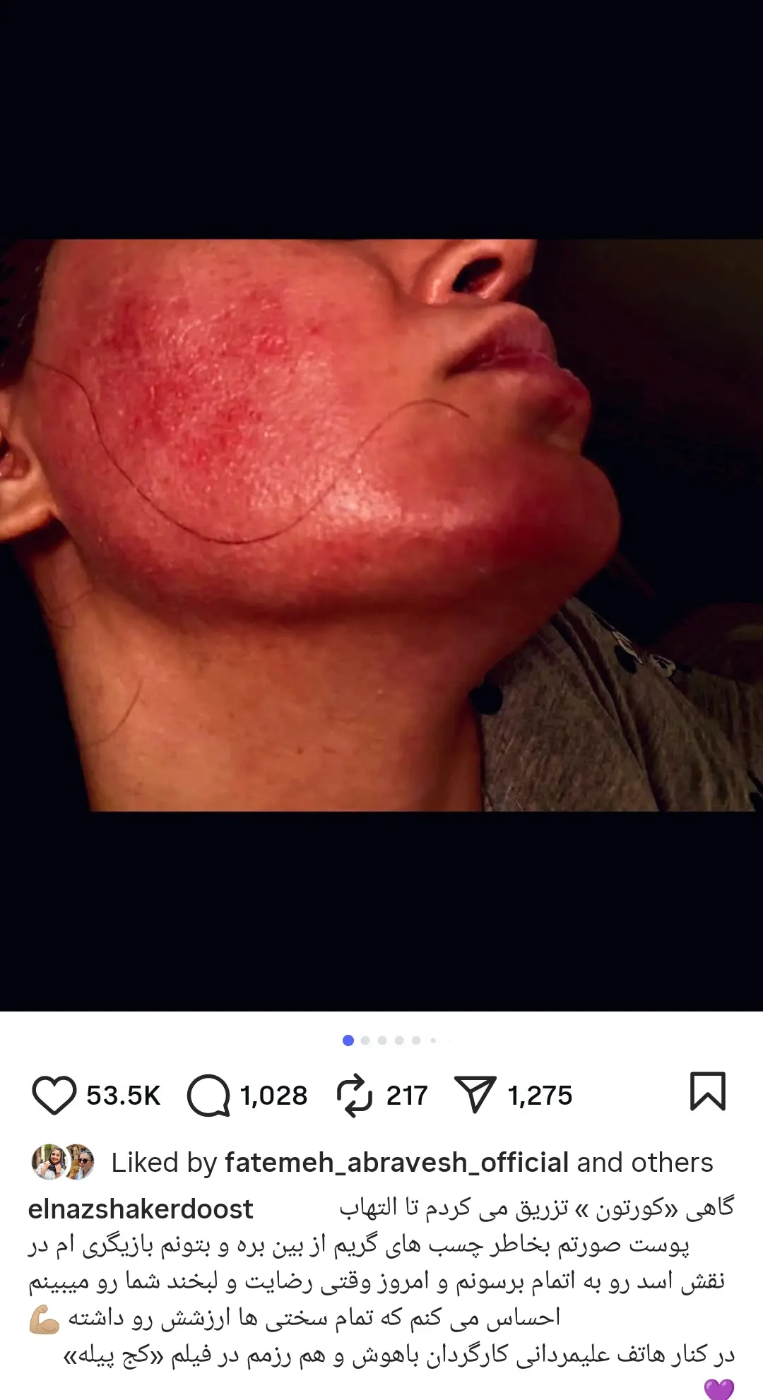 الناز شاکردوست