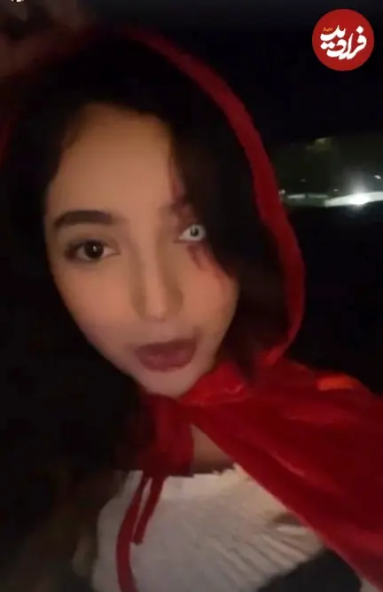 بازیگر کودک سریال آوای باران با چشم مصنوعی