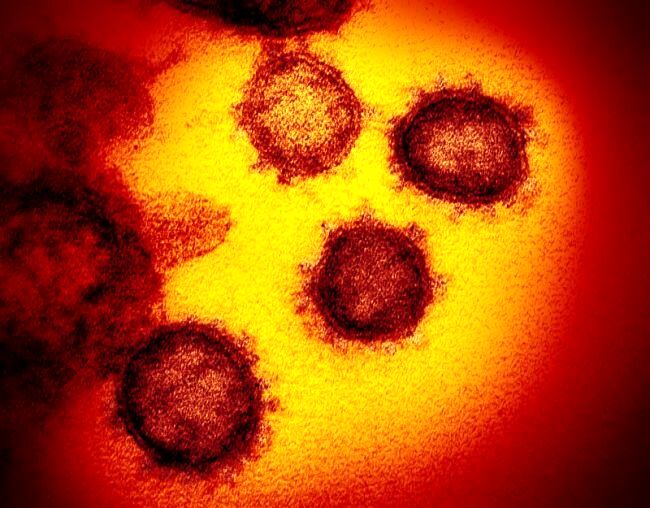 تصاویری واقعی از کروناویروس