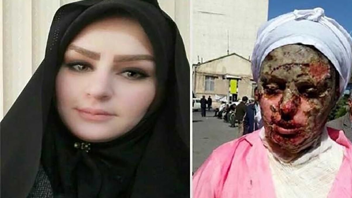 اسیدپاشی در تبریز