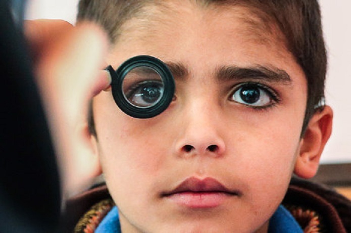 تغییرات برنامه زمانی غربالگری بینایی کودکان