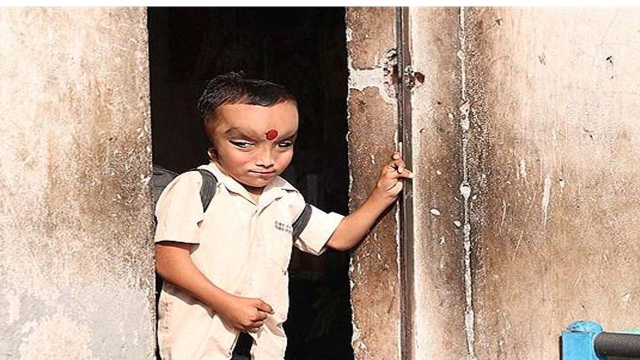 کودک عجیب الخلقه هندی