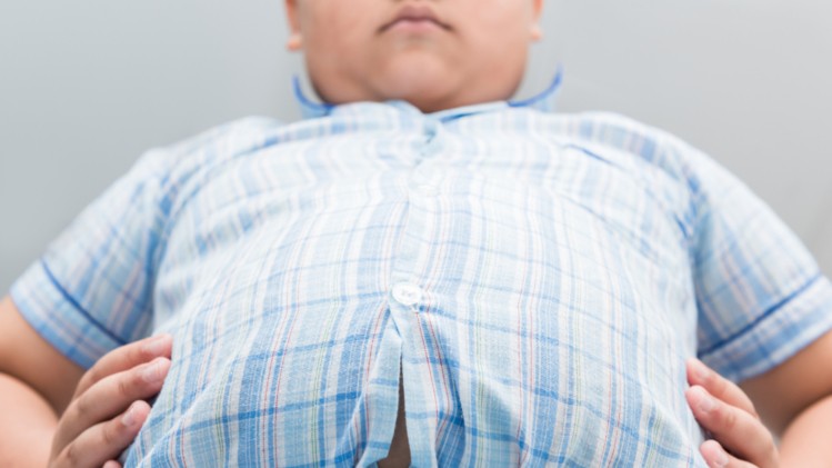افزایش کودکان چاق در ایران