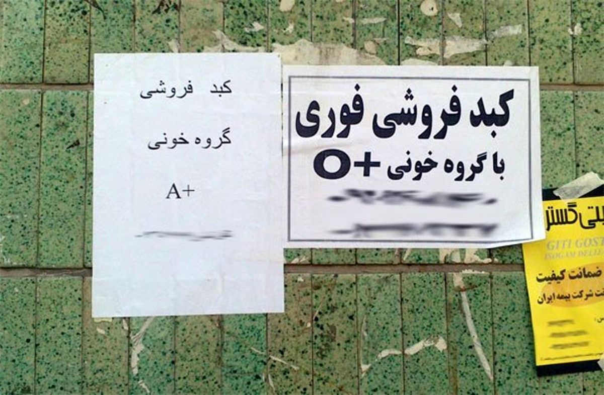  خرید و فروش کبد در ایران
