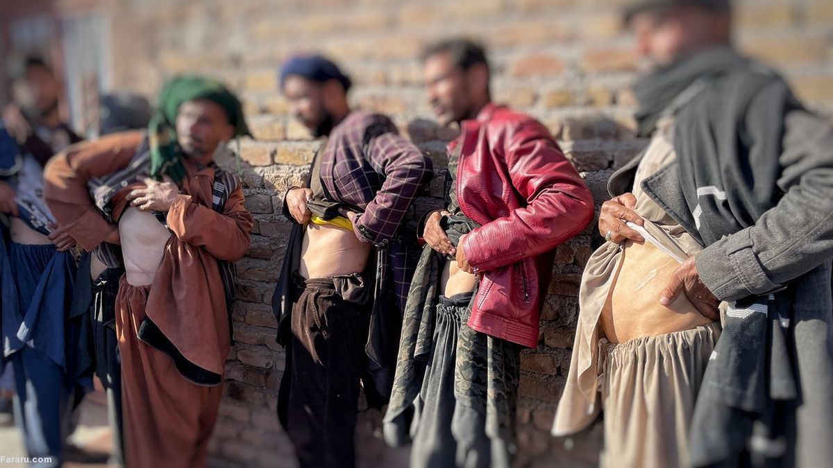 فروش کلیه برای زنده ماندن در افغانستان