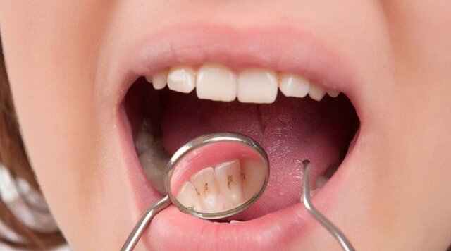 سلامت دندانها