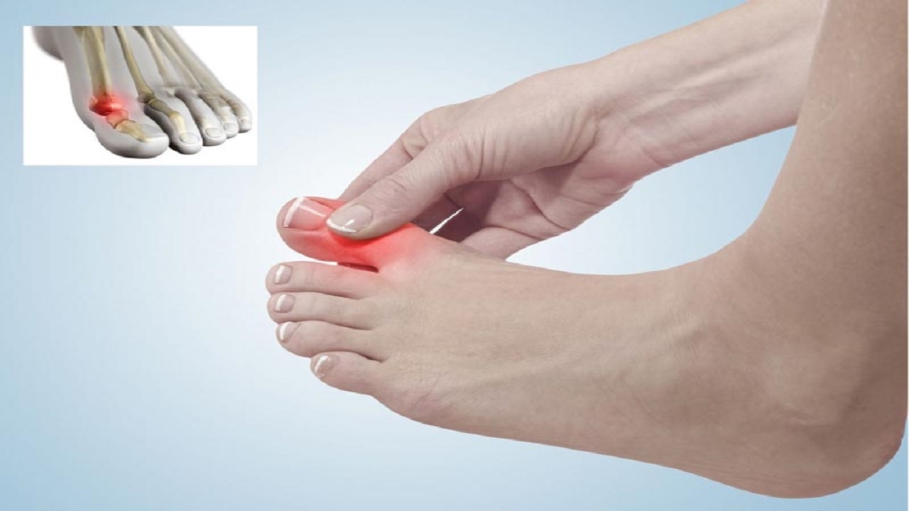 بیماری‌هایی که منجر به بروز درد در انگشت شست پا می‌شوند