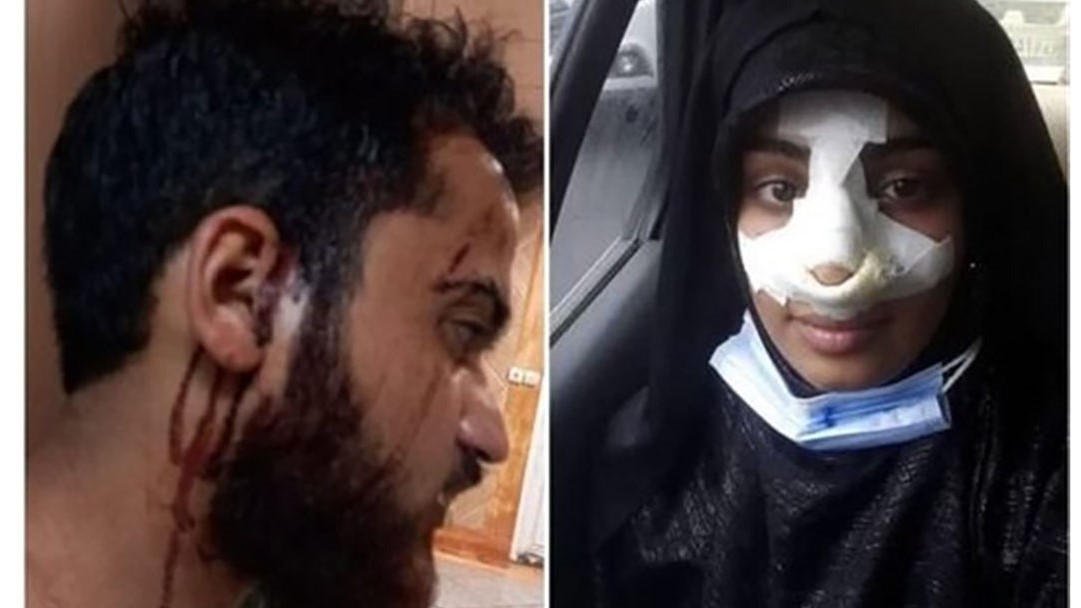 کتک زدن طلبه جوان و همسرش در مهرشهر کرج 