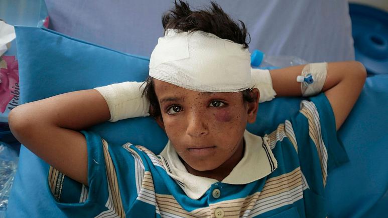 روزانه چهار کودک یمنی کشته یا معلول می‌شوند