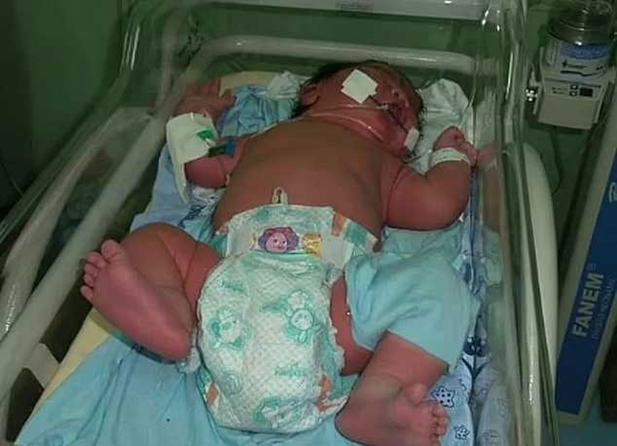 تصویری حیرت انگیز از بزرگترین نوزاد ۷ کیلویی