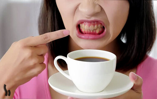 تاثیر مخرب نوشابه و قهوه بر دندان‌ها