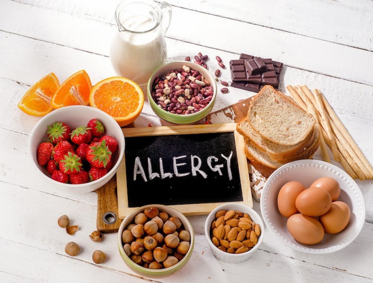 آلرژی یا حساسیت غذایی را بیشتر بشناسید