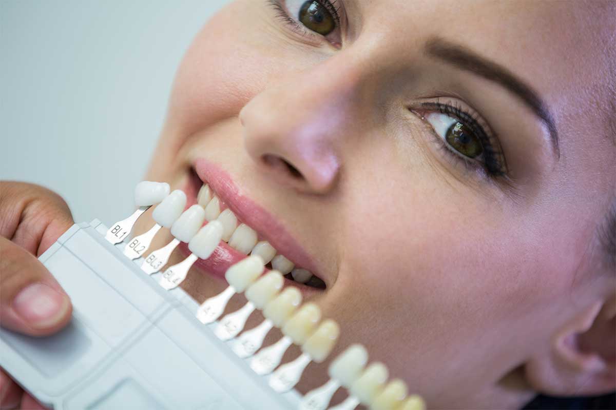 روش‌های خانگی برای ازبین‌بردن زردی دندان