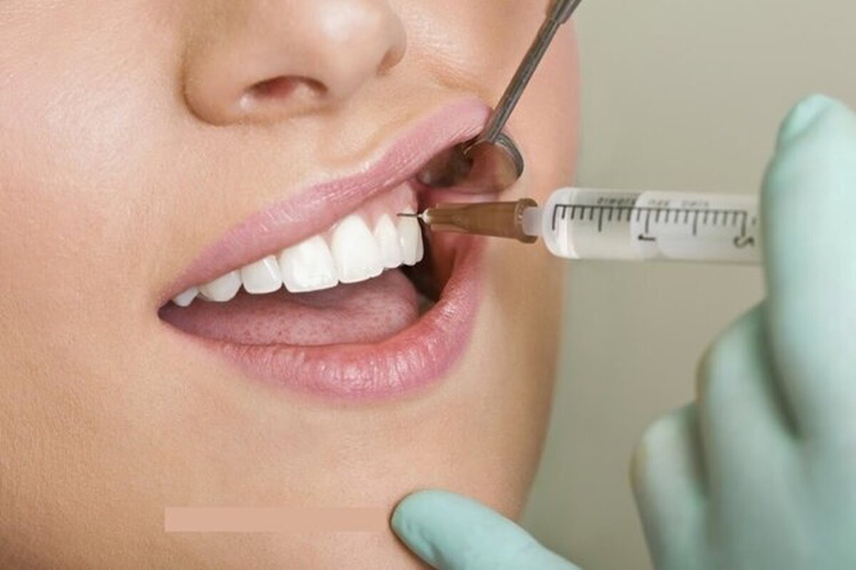 مضرات جرم‌ گیری برای دندان