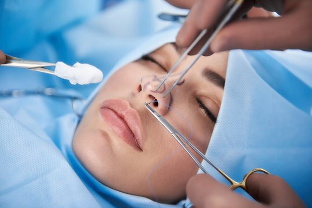 بررسی دلایل کاهش سن تقاضا برای جراحی زیبایی