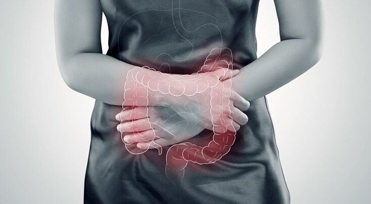 ۵ راهکار برای تقویت سلامت روده ۵ راهکار برای تقویت سلامت روده