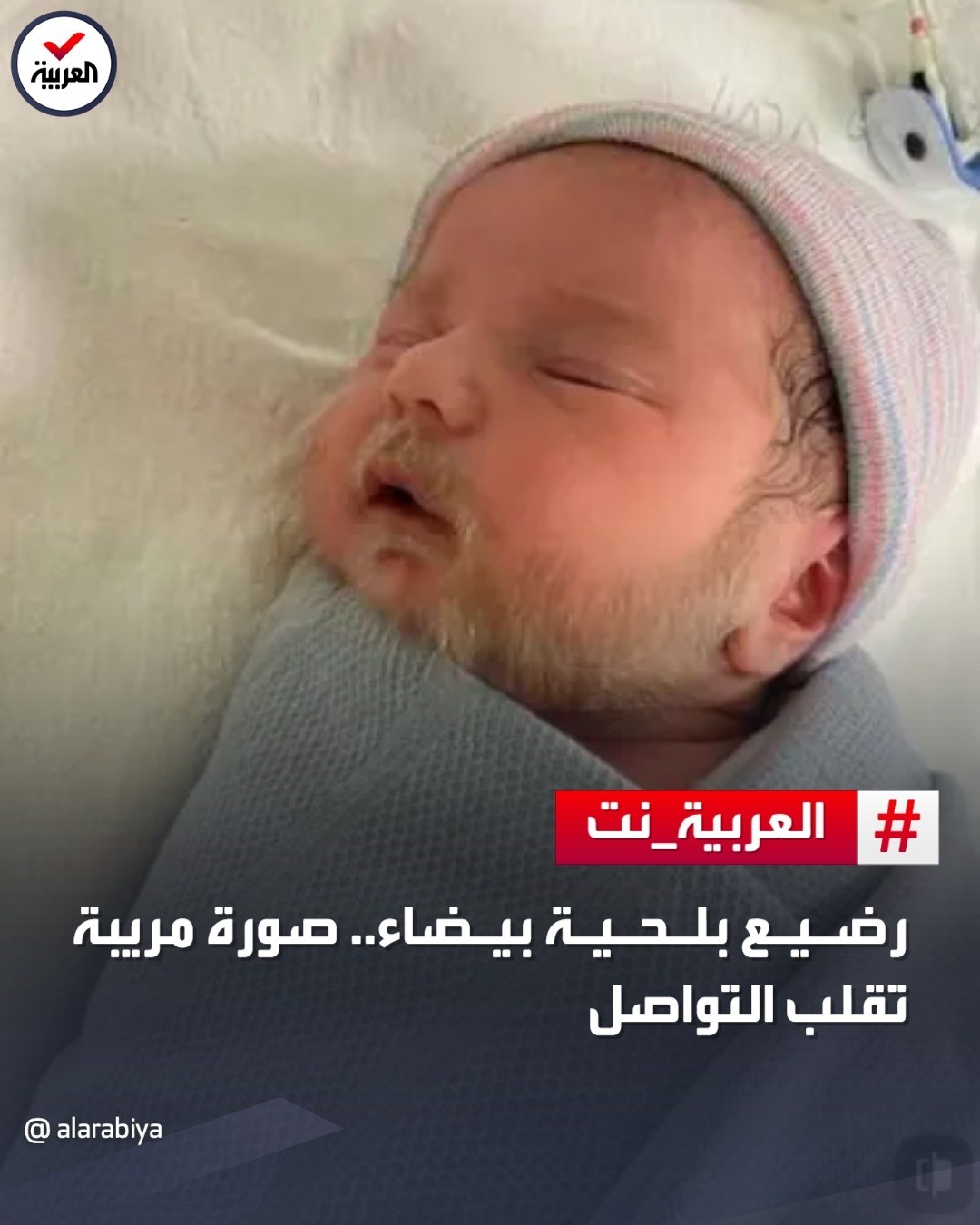 تولد نوزادی با ریش سفید در فرانسه+عکس