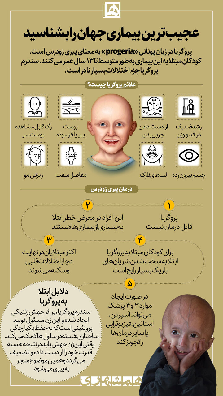 عجیب‌ترین بیماری جهان