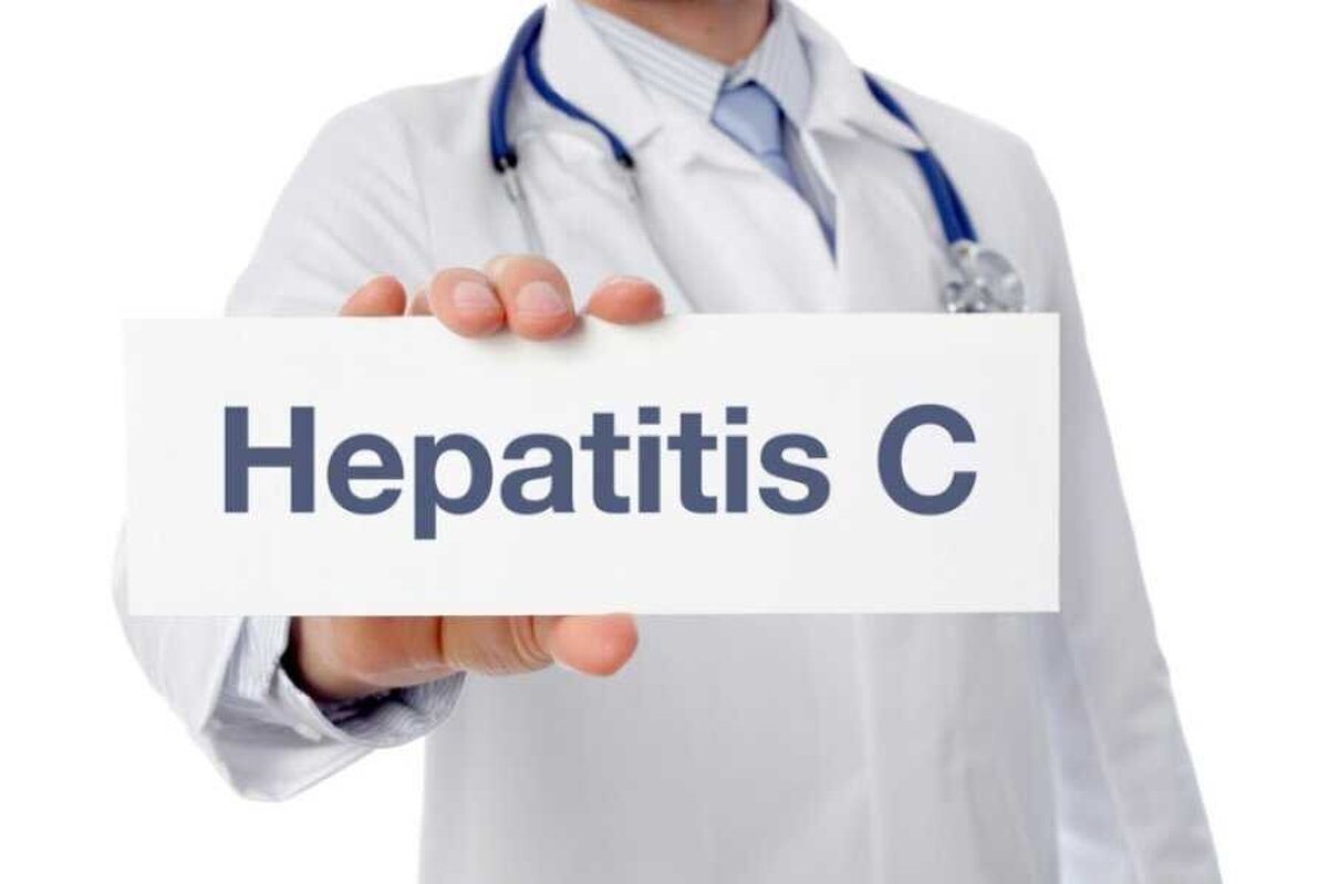درمان رایگان بیماران هپاتیت C