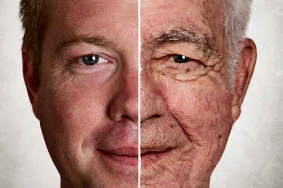 مقصر واقعی پیری صورت مشخص شد