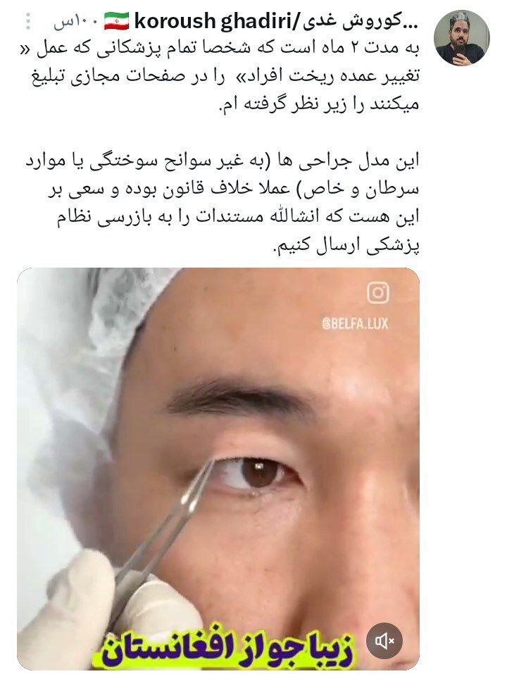 عکس/ تغییر چهره افغانی‌های مقیم ایران به دست جراحان پلاستیک برخلاف قانون