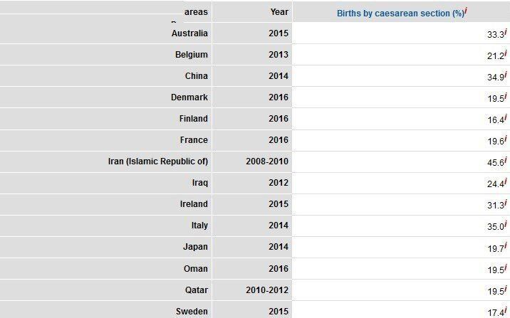 سزارین در ایران ۳ برابر استاندارد جهانی