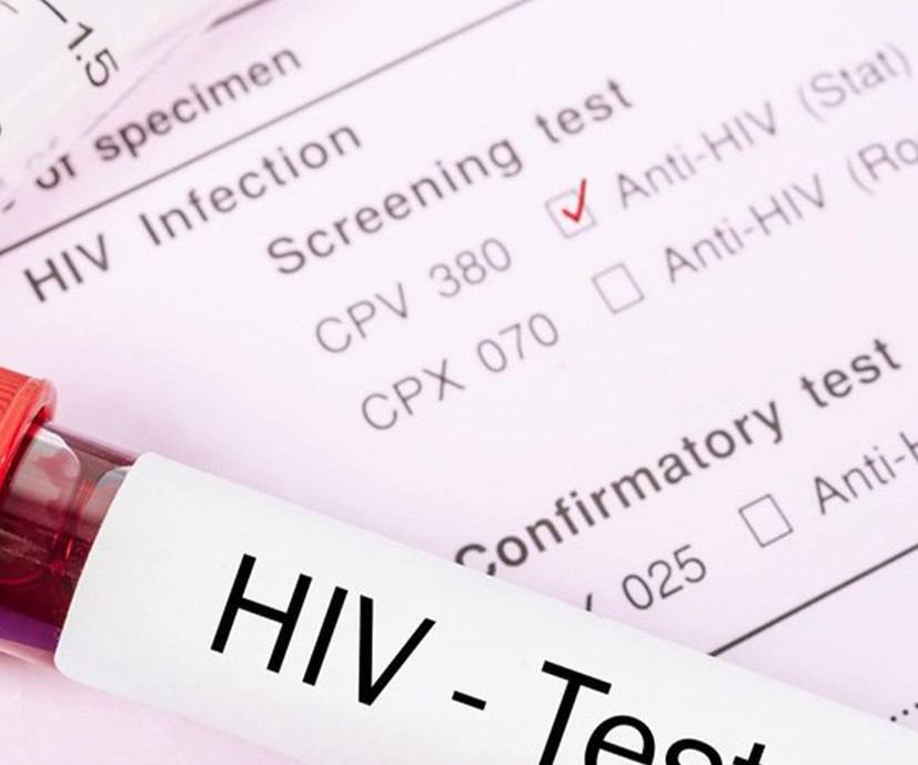 آمار تکاندهنده از مبتلایان به بیماری HIV در ایران