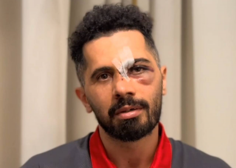 امید عالیشاه جراحی شد