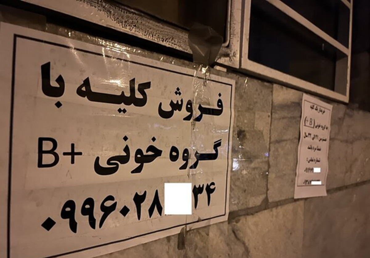 ماجرای تکان‌دهنده از فروش کلیه ۷۰میلیاردی در تهران