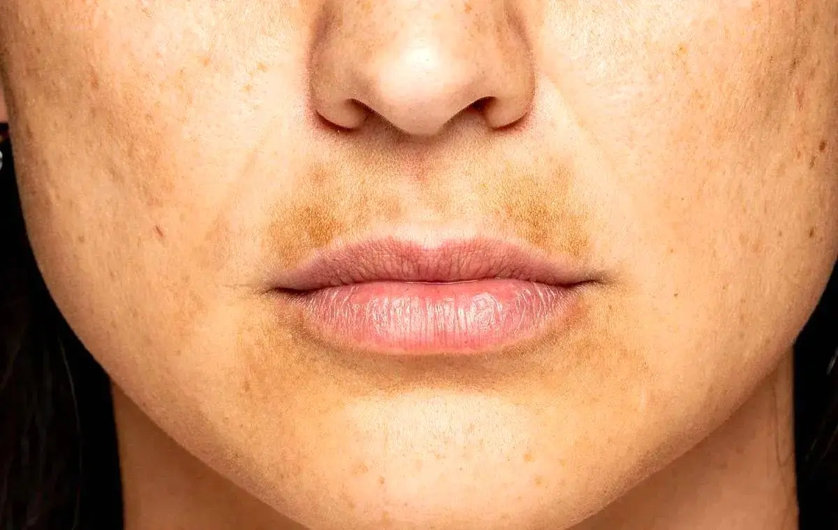 مراقبت از پوست مراقبت از پوست