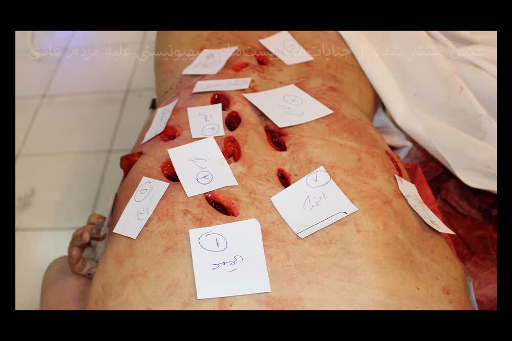 بدن‌هایی که با قمه سوراخ‌سوراخ شده‌اند