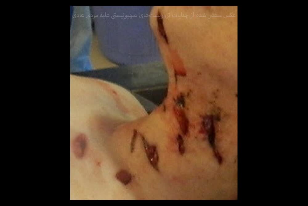 بدن‌هایی که با قمه سوراخ‌سوراخ شده‌اند