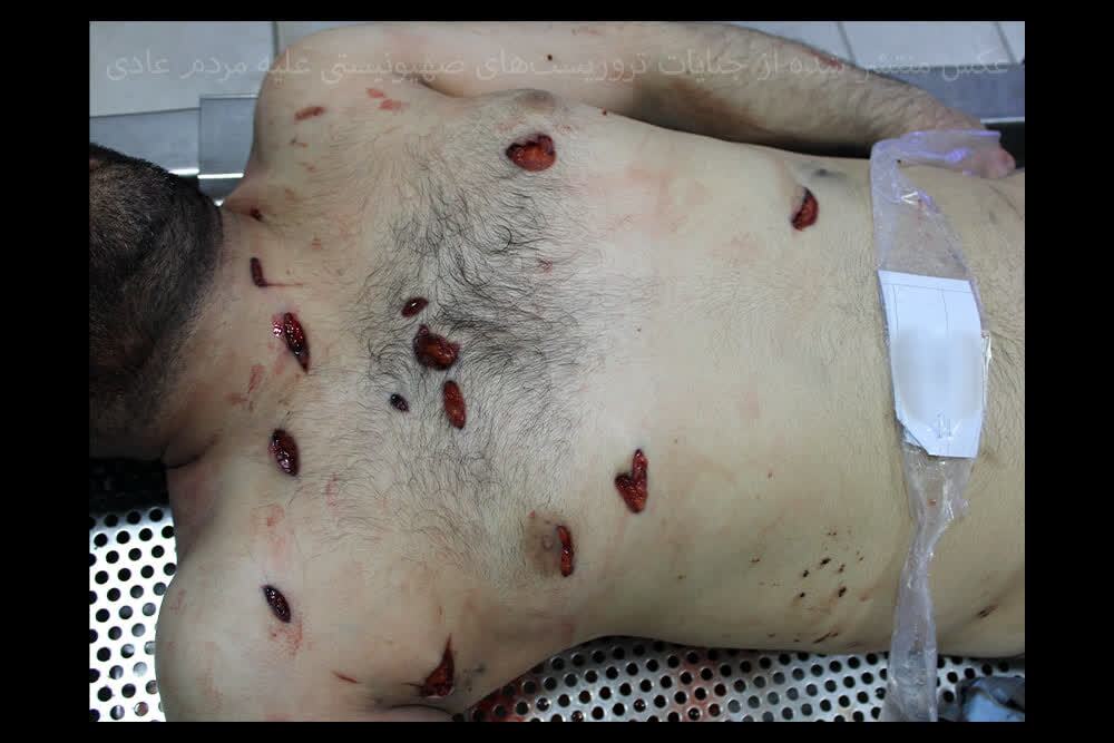 بدن‌هایی که با قمه سوراخ‌سوراخ شده‌اند