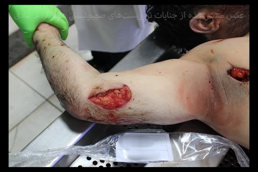 بدن‌هایی که با قمه سوراخ‌سوراخ شده‌اند