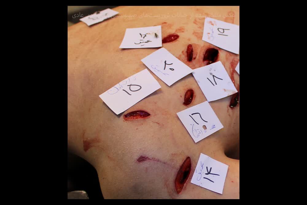 بدن‌هایی که با قمه سوراخ‌سوراخ شده‌اند