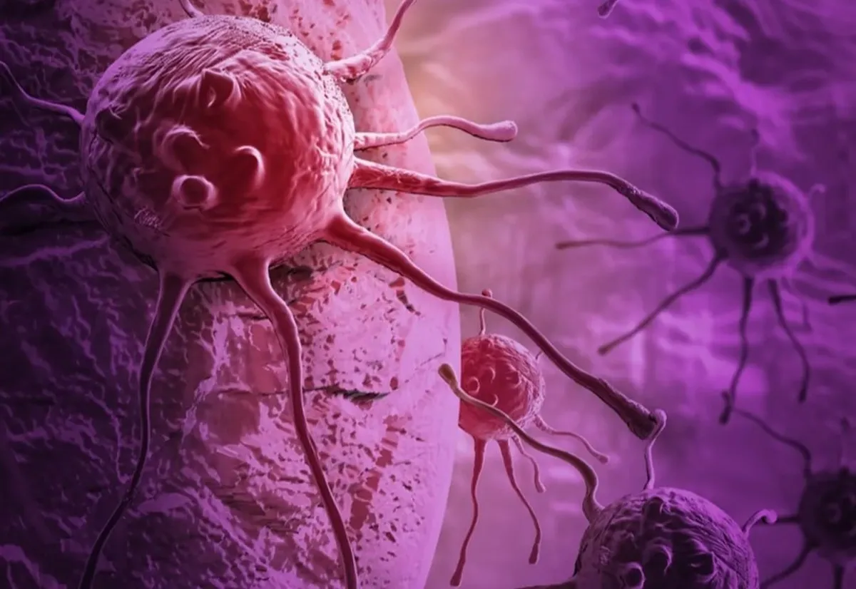 بیماری سرطان