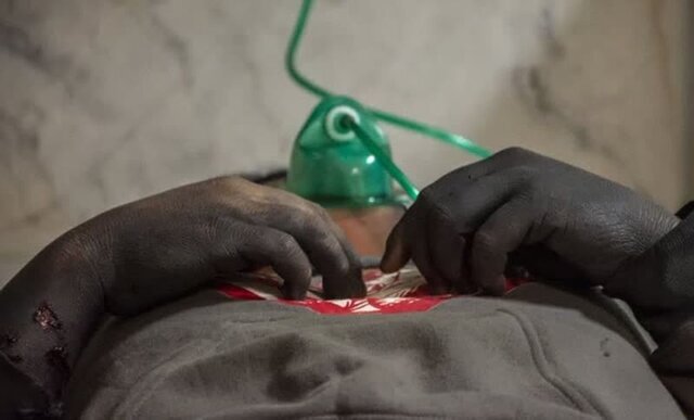 آخرین آمار‌ها از تعداد مصدومان چهارشنبه سوری تا کنون/ ۱۲۱ نفر سوختند