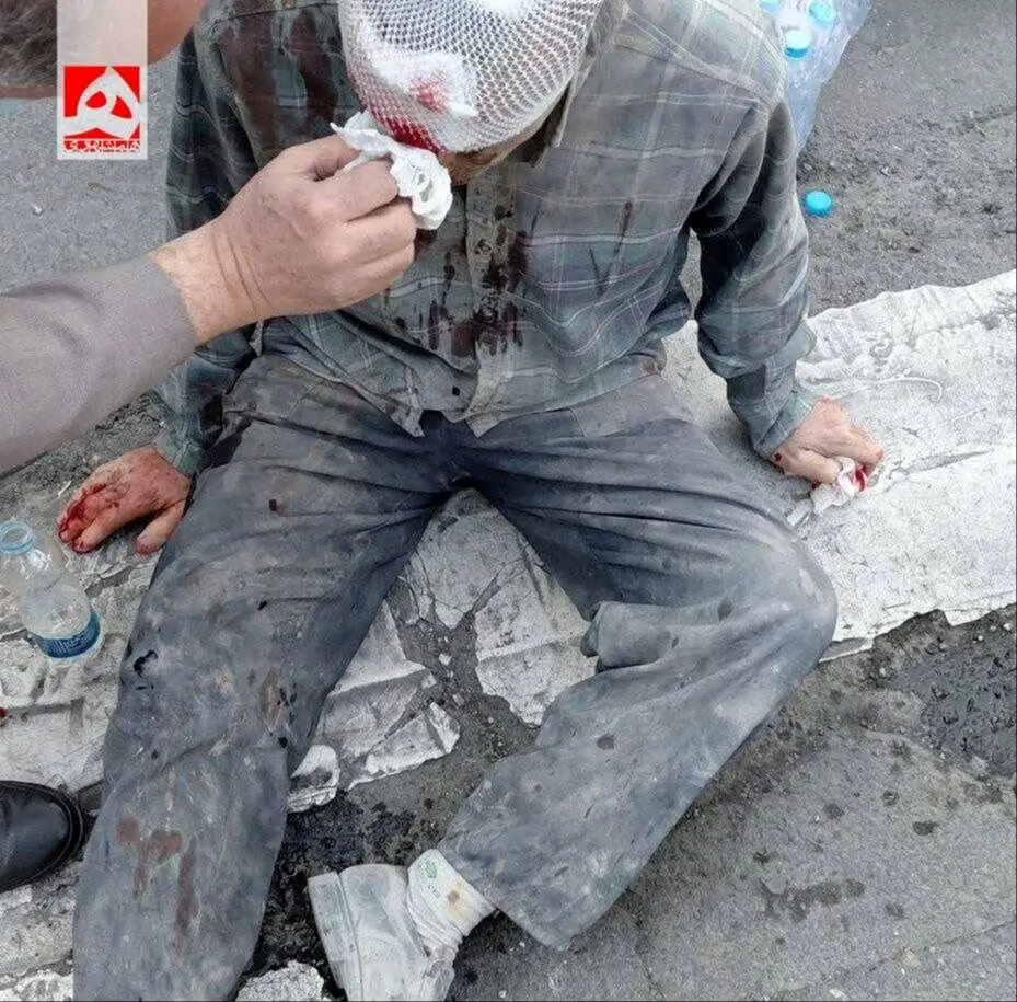 اولین تصویر از مجروحان حمله امروز صبح اسرائیل به تهران