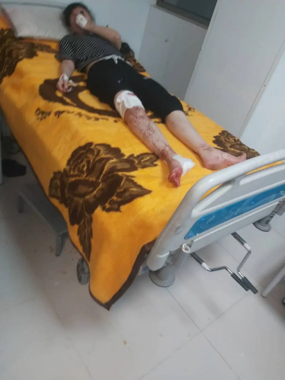 زخمی‌های حمله به سالن ورزشی در لامرد