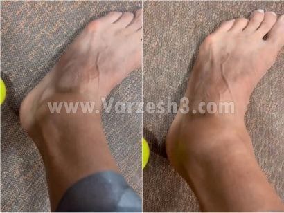 مچ‌پای رامین رضاییان