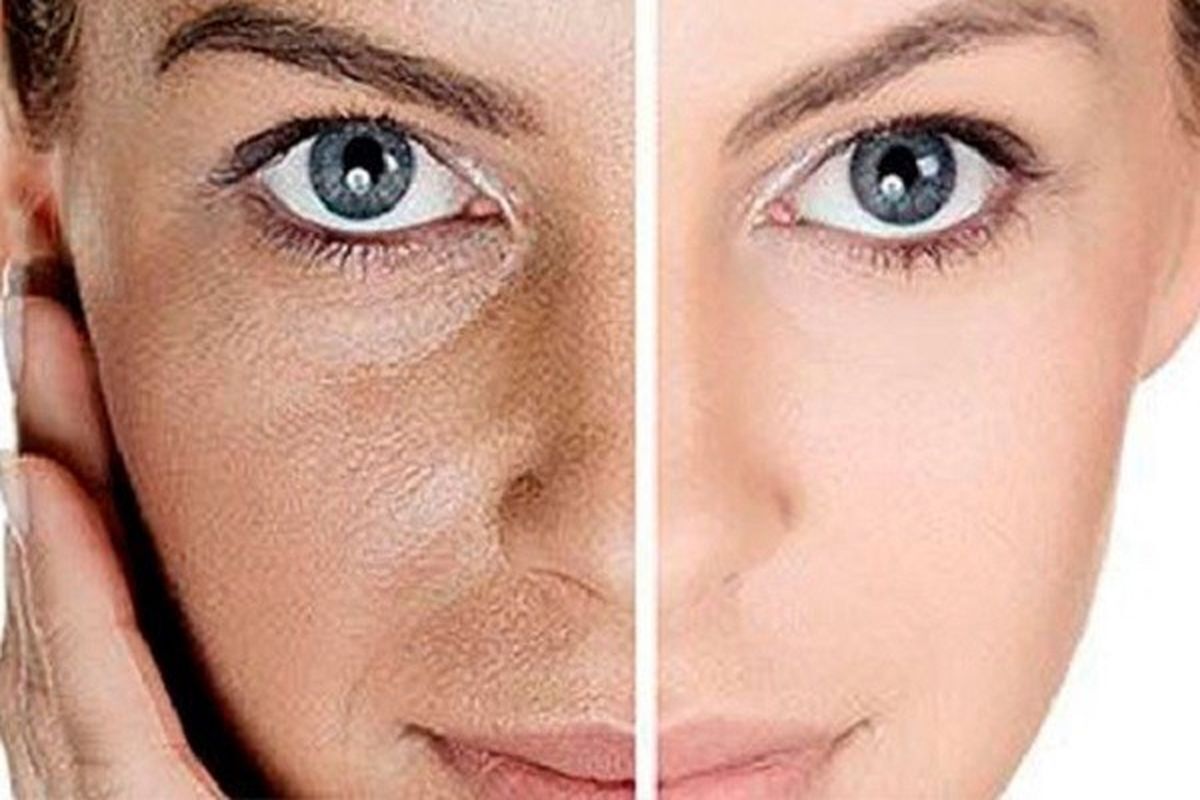 مقایسه پوست جوان و پوست پیر مقایسه پوست جوان و پوست پیر