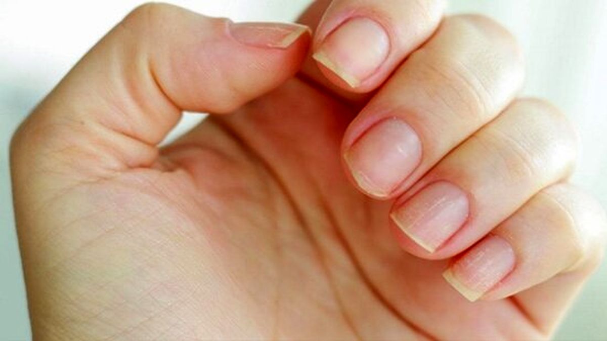 تقویت ناخن‌ها با سبزیجات برگ‌دار تیره