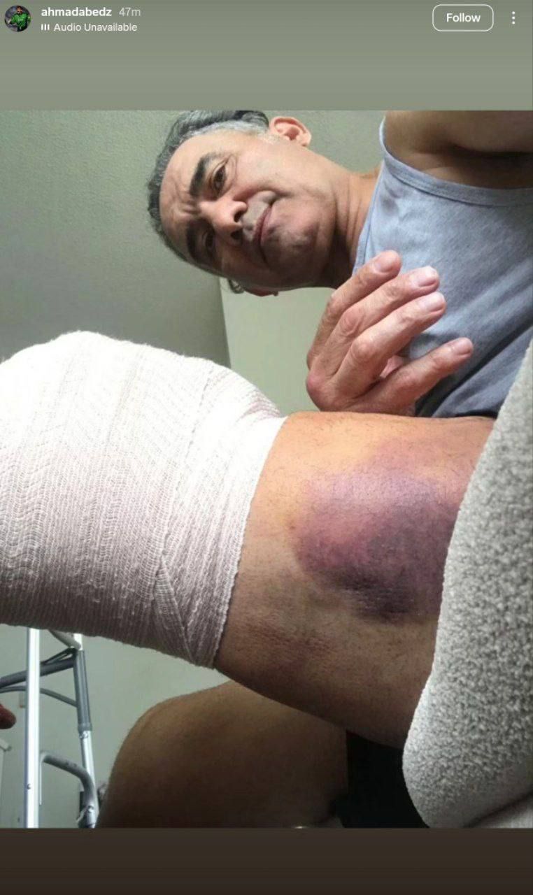 جراحی پای عابدزاده