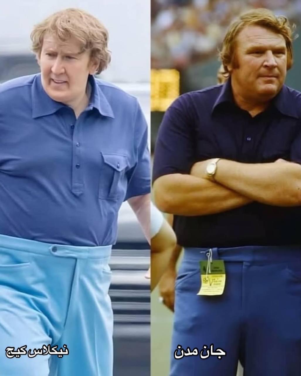 تغییر چهره بازیگر معروف