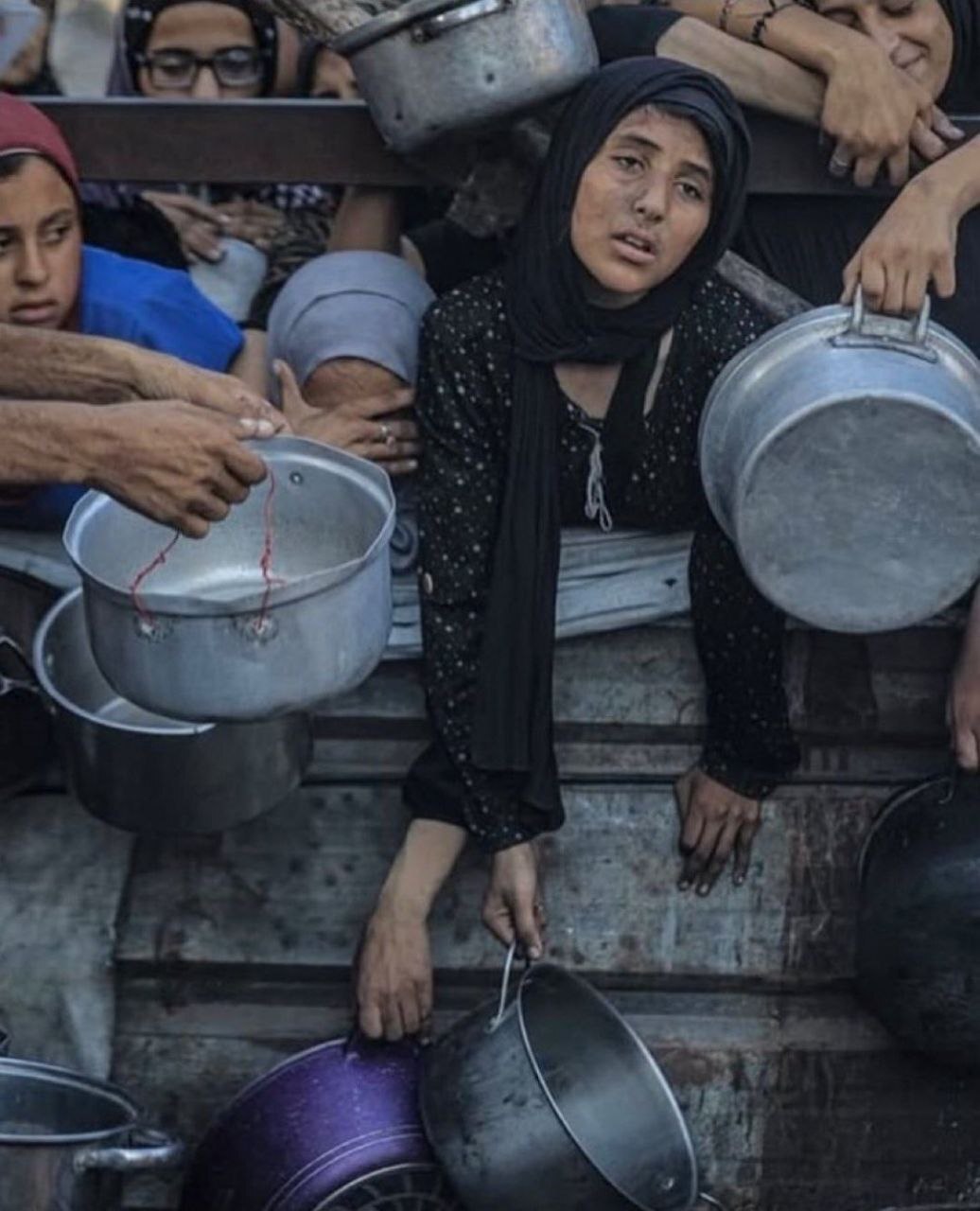 صحنه‌های دلخراش گرسنگی در نوار غزه