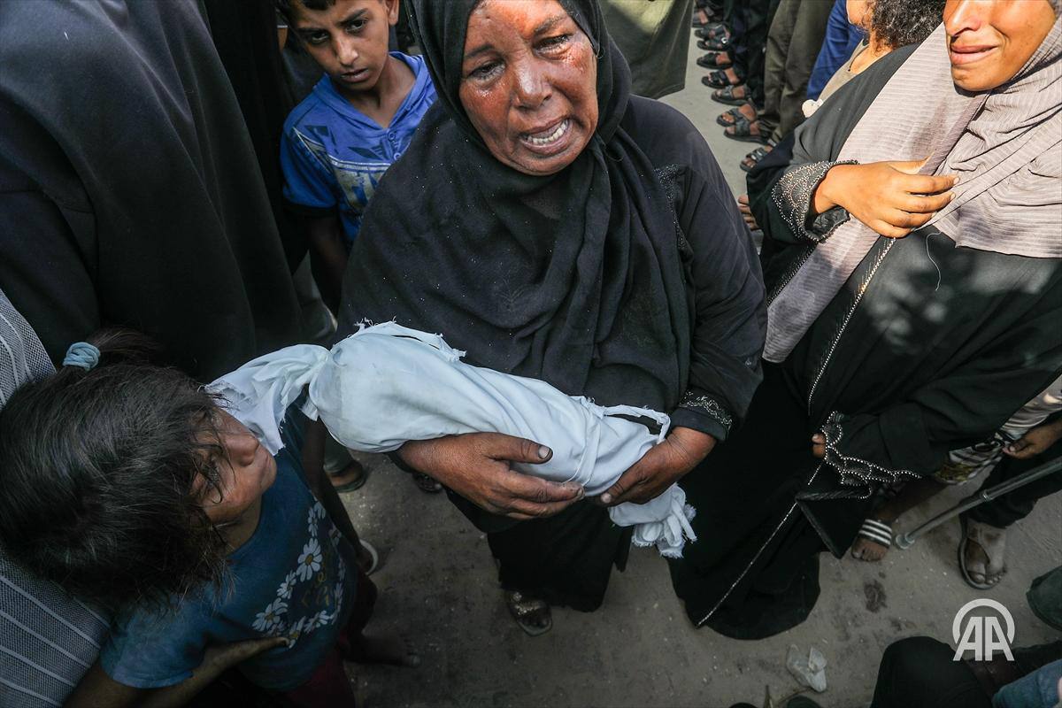 سوءتغذیه در نوار غزه