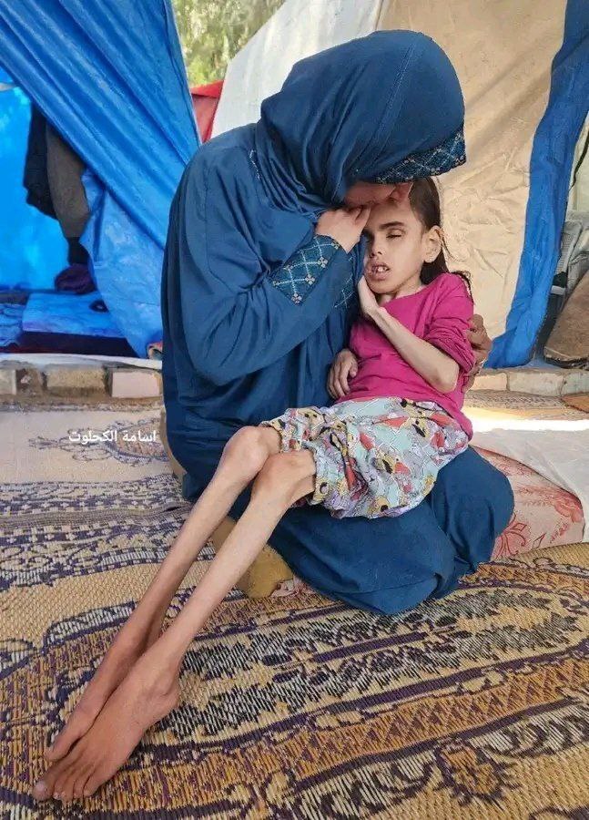 صحنه های غم‌انگیز نوار غزه