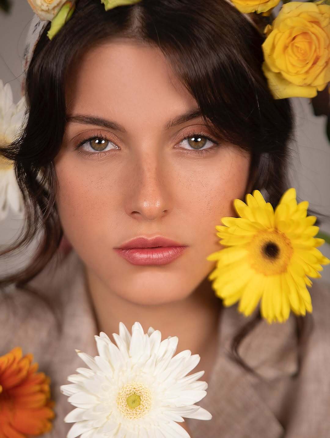 بازیگر خوش‌چهره زخم کاری