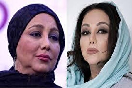 عکس/ تغییر عجیب چهره بهنوش بختیاری با گریم جدیدش