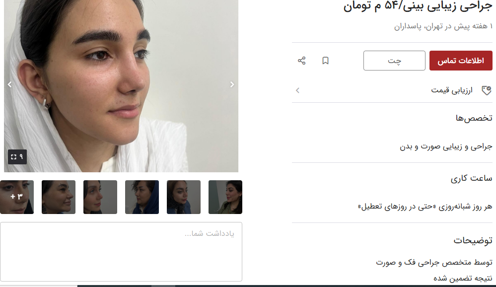 هزینه بالای عمل بینی هزینه بالای عمل بینی